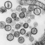 Breaking: New Virus in town – “Hanta-virus”